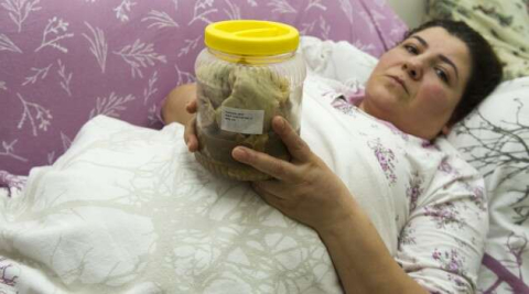 Hastane ve doktordan büyük ihmal! Karnında 1.8 kilo...