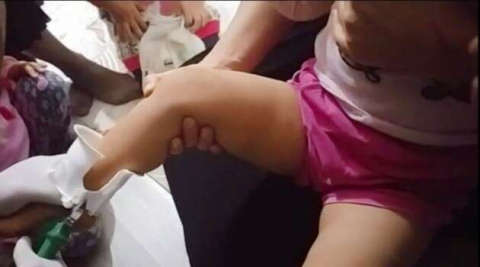 Çocuğun ayağına sıkışan tuvalet kapağı itfaiye tarafından çıkarıldı