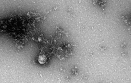 Rusya’da, korona virüs mutasyonunun fotoğrafı çekildi