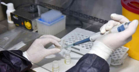 Covid-19 aşılarının antikor sonuçları karşılaştırıldı