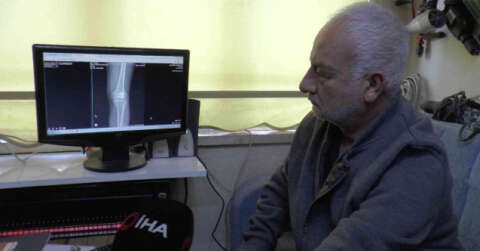 Diz kapağındaki mermi 13 gün sonra fark edildi