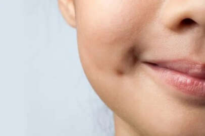 Gamze Estetiği İle Güzel Gülüşler