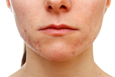 Makyaj yapmadan iyi düşünün