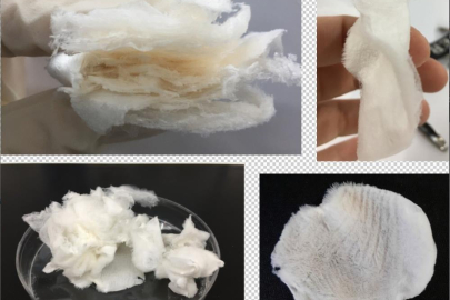 BTÜ'lü araştırmacılar o hastalığa çare oluyor