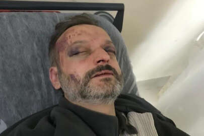 Bursa'da çiftetelli çalmadı, öldüresiye dövüldü..