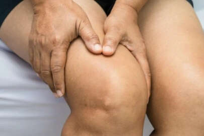 Diz kireçlenmesi ve tedavisi