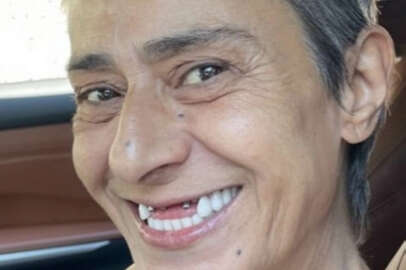 Yıldız Tilbe'den dişsiz fotoğraflar