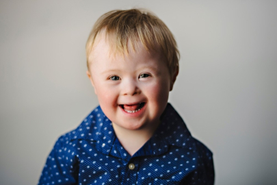 Down sendromu bir hastalık değil, farklılık