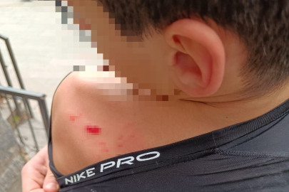 14 yaşındaki çocuğa öldüresiye darp iddiası