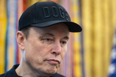 Elon Musk’ın yüzüne ne oldu? İlk kez açıkladı