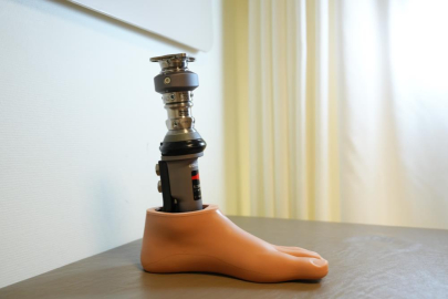 Bu yöntem amputasyon hastalarına umut oldu