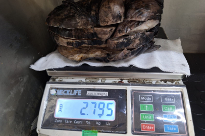 Nefes darlığıyla gitti, göğsünden 3 kg tümör çıktı
