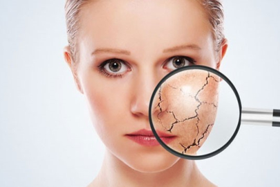 Cildiniz için kışa hazırlık reçetesi