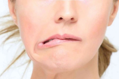 "Yüz felci riskine karşı soğuk havalarda yüzünüzü koruyun"