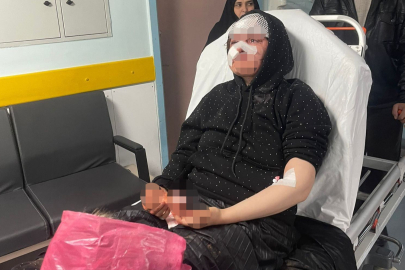 Boşanmak isteyen karısını öldüresiye darp eden koca tutuklandı