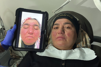 Hastalığı yüzünden yıllarca evden çıkamadı, şimdi ise çekinmeden çıkabiliyor