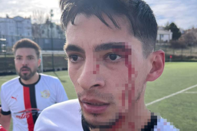 Maç sonrası saha içi savaş alanına döndü