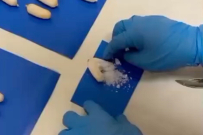 Türkiye'ye midesinde uyuşturucu sokan şahıslara operasyon