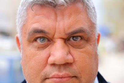 3 renkli gözleriyle görenlerin ilgisini çekiyor