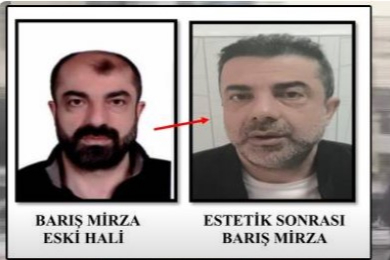 Ameliyat ile yüzünü değiştiren firari cinayet zanlısı, 7 yıl sonra yakalandı