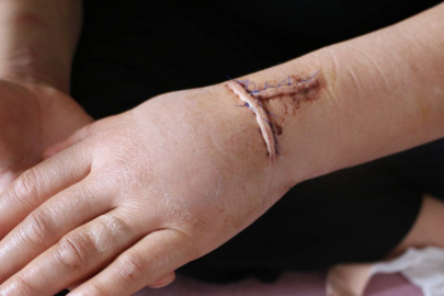 Resmen dehşet: Nikahlı eşini 30 yerinden bıçakladı