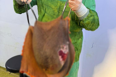 Karnından 40 kilogram kitle çıkarıldı