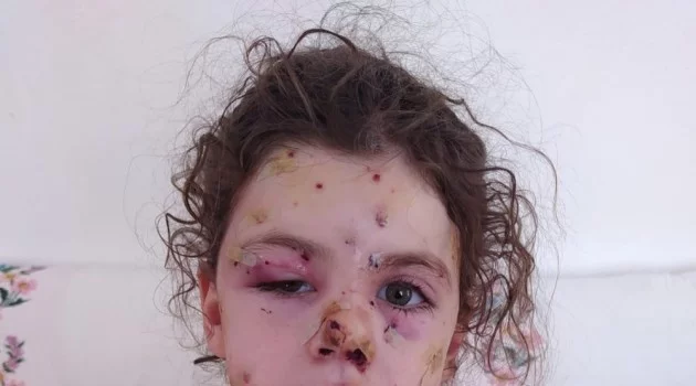 İzmir’de yasak dinlemeyen magandalar 5 yaşındaki Neriman’ı silahla yaraladı