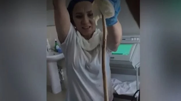 Rusya’da uyuyan kadının ağzından giren yılan ameliyatla çıkarıldı